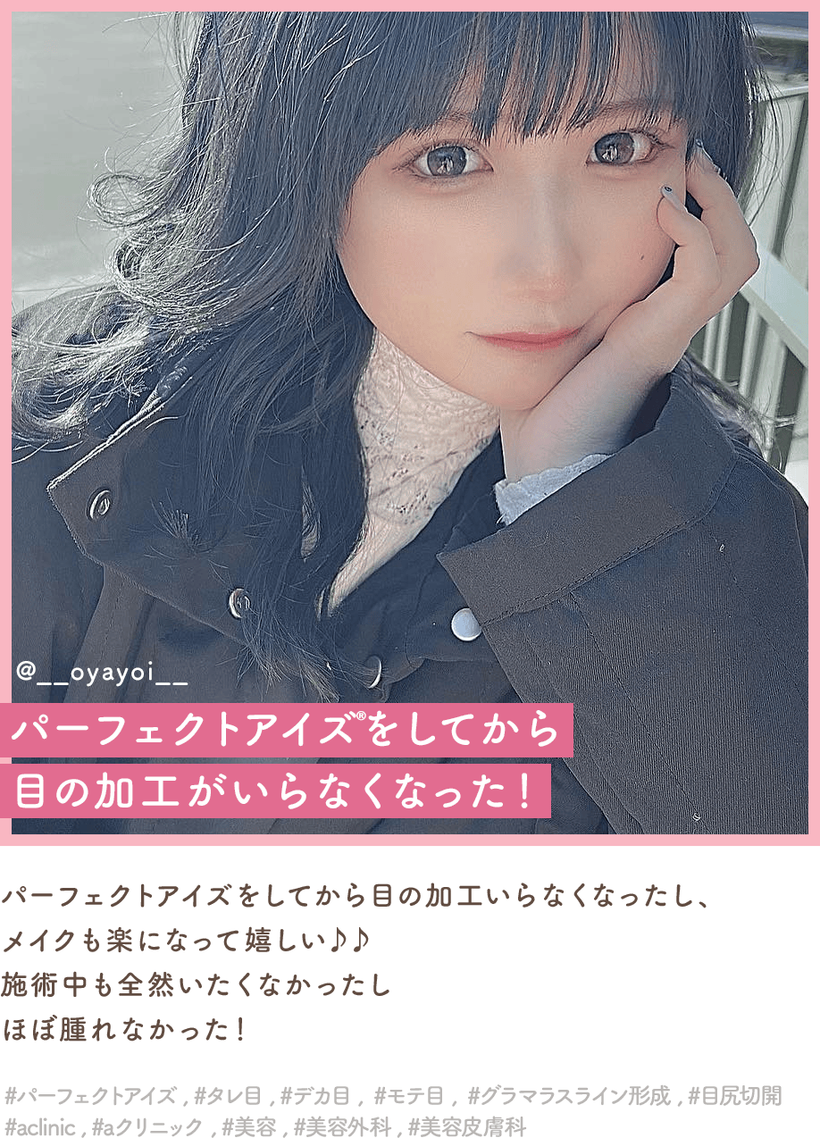 パーフェクトアイズインフルエンサー2