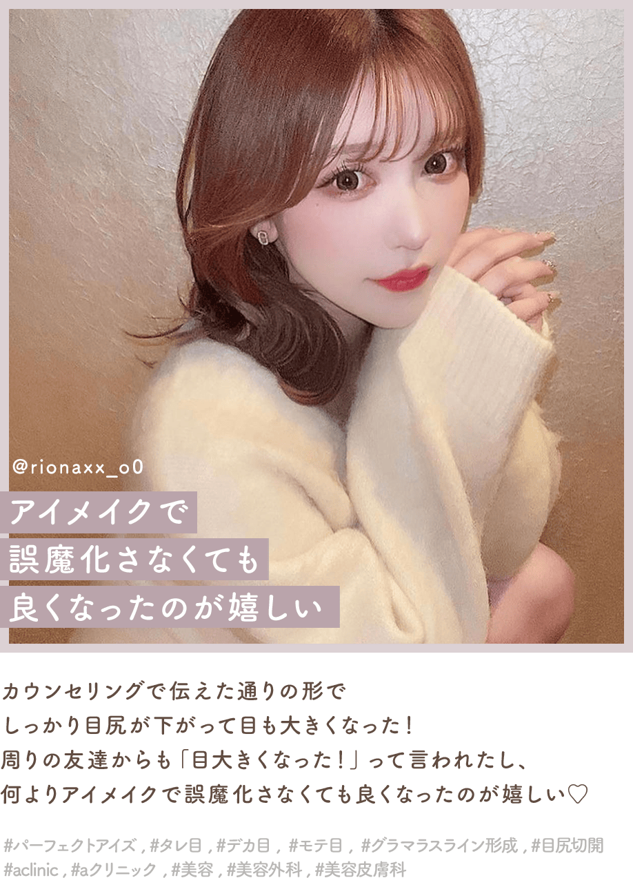 パーフェクトアイズインフルエンサー3