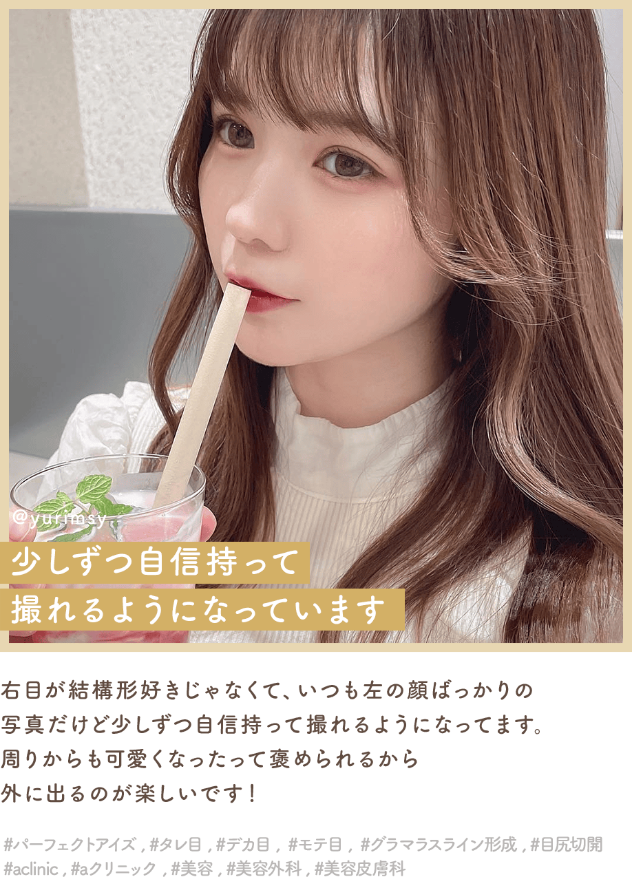 パーフェクトアイズインフルエンサー4