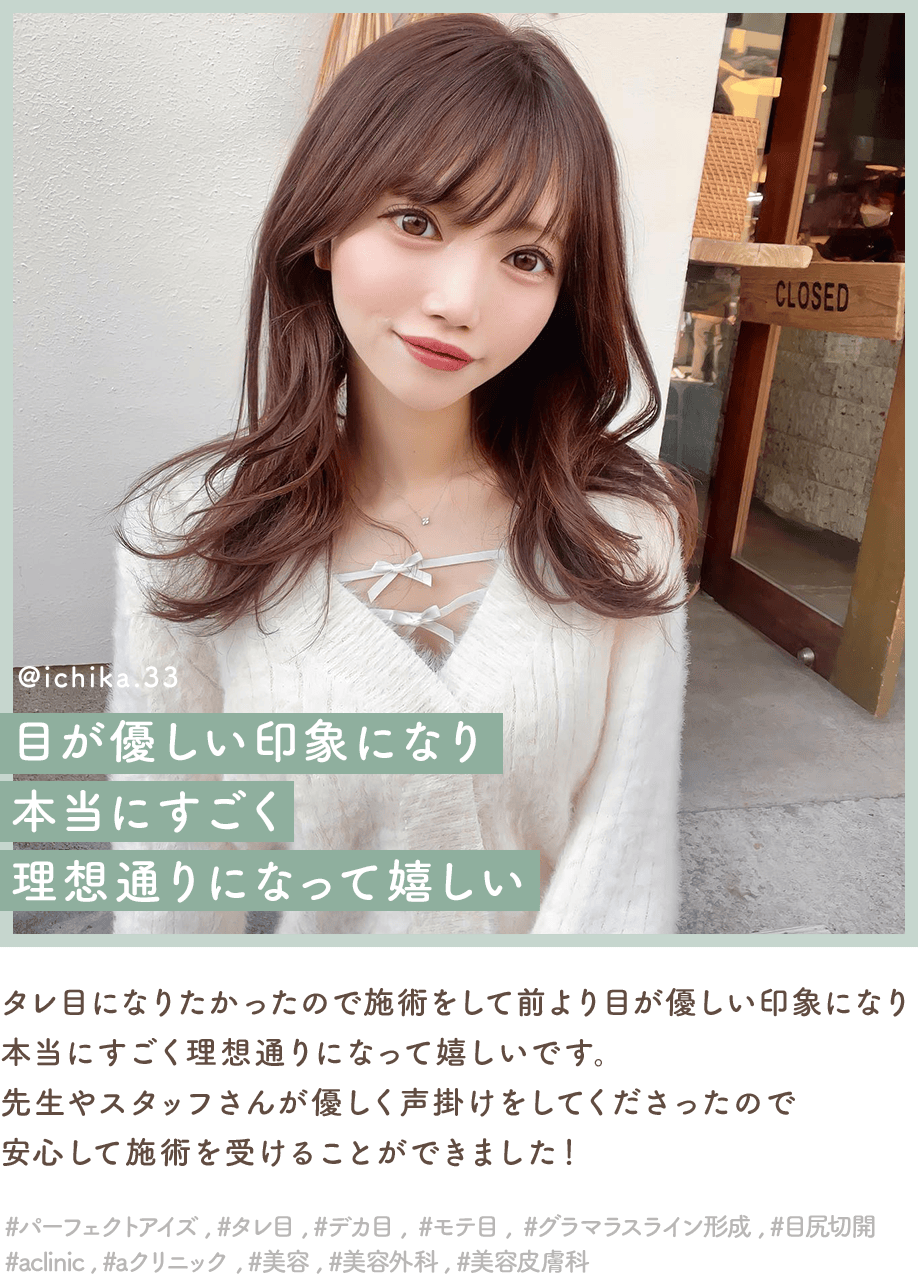 パーフェクトアイズインフルエンサー5