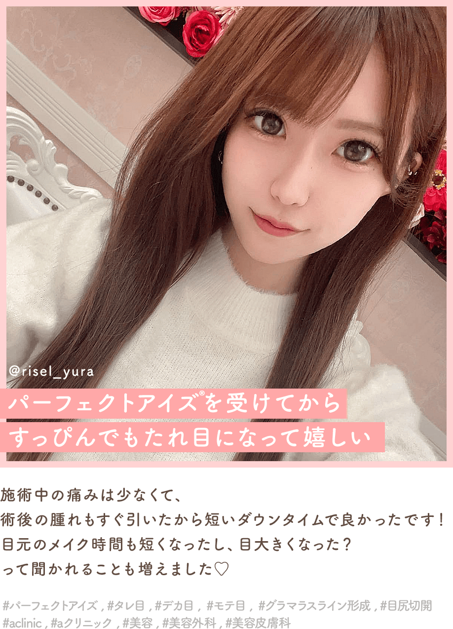 パーフェクトアイズインフルエンサー6