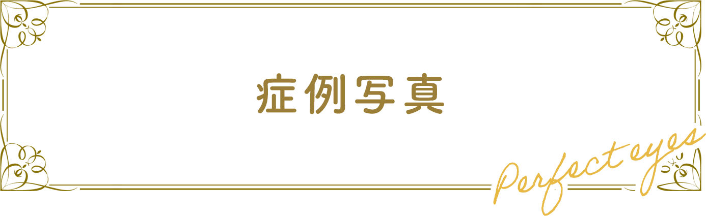 症例写真