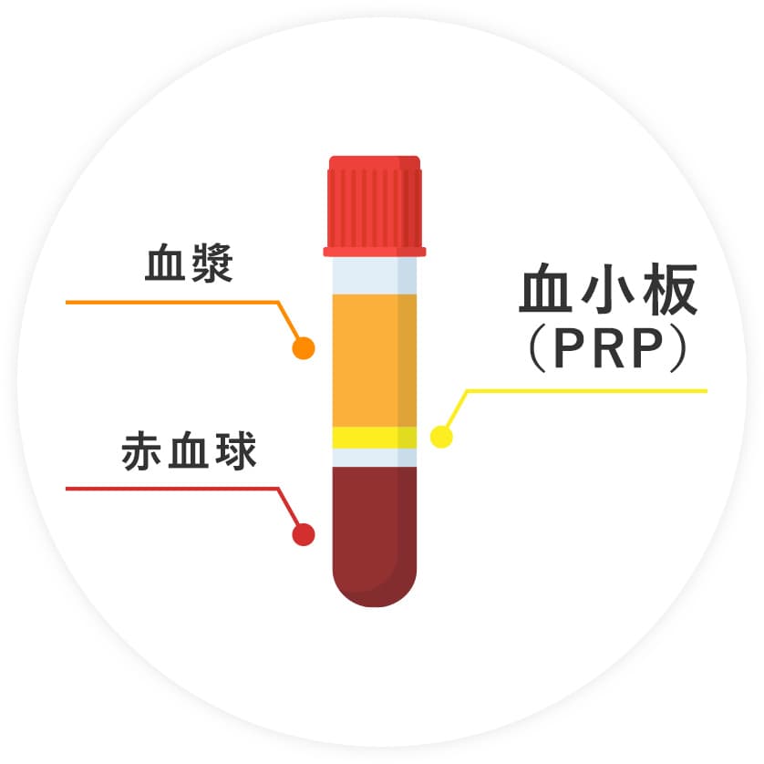 PRP(血小板療法)