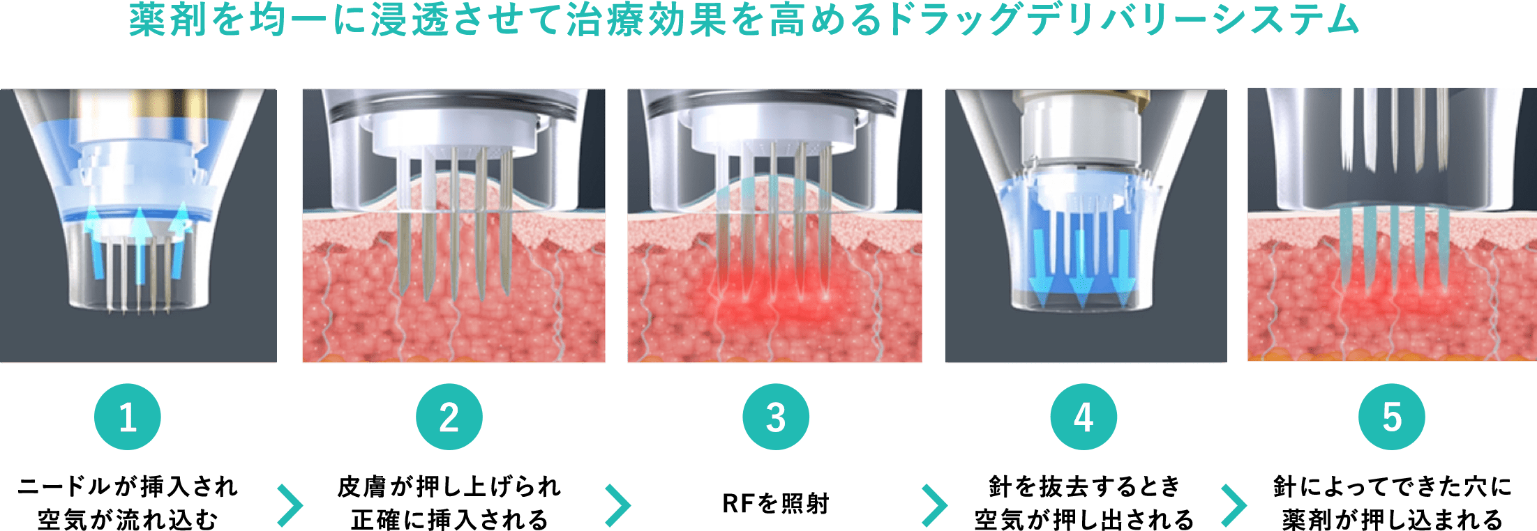 ドラッグデリバリー機能