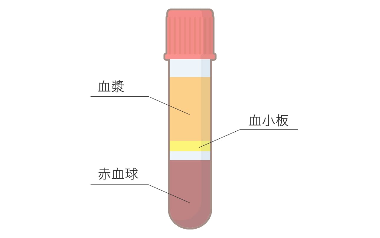 PRP血小板療法