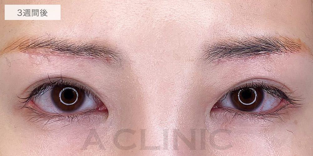 症例写真13