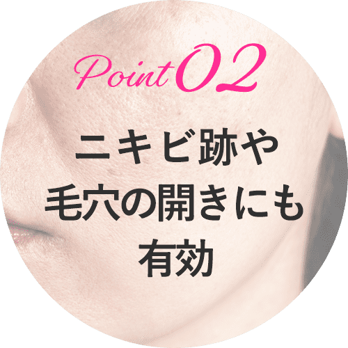 ダーマペン4