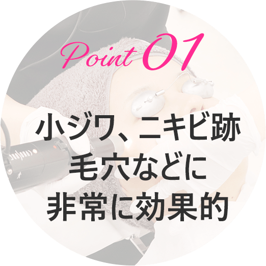 ピコフラクショナル