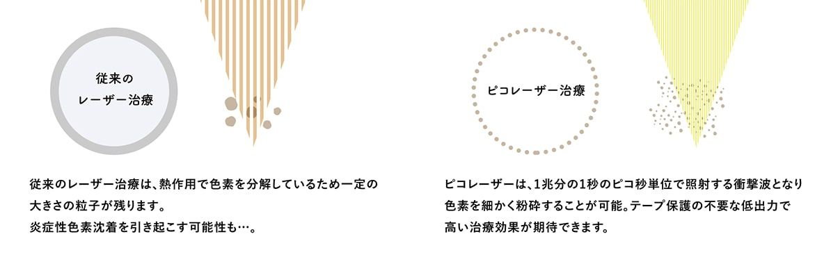 ピコフラクショナルの治療効果
