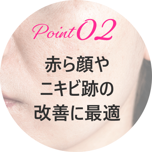 フォトシルクプラス(光治療)