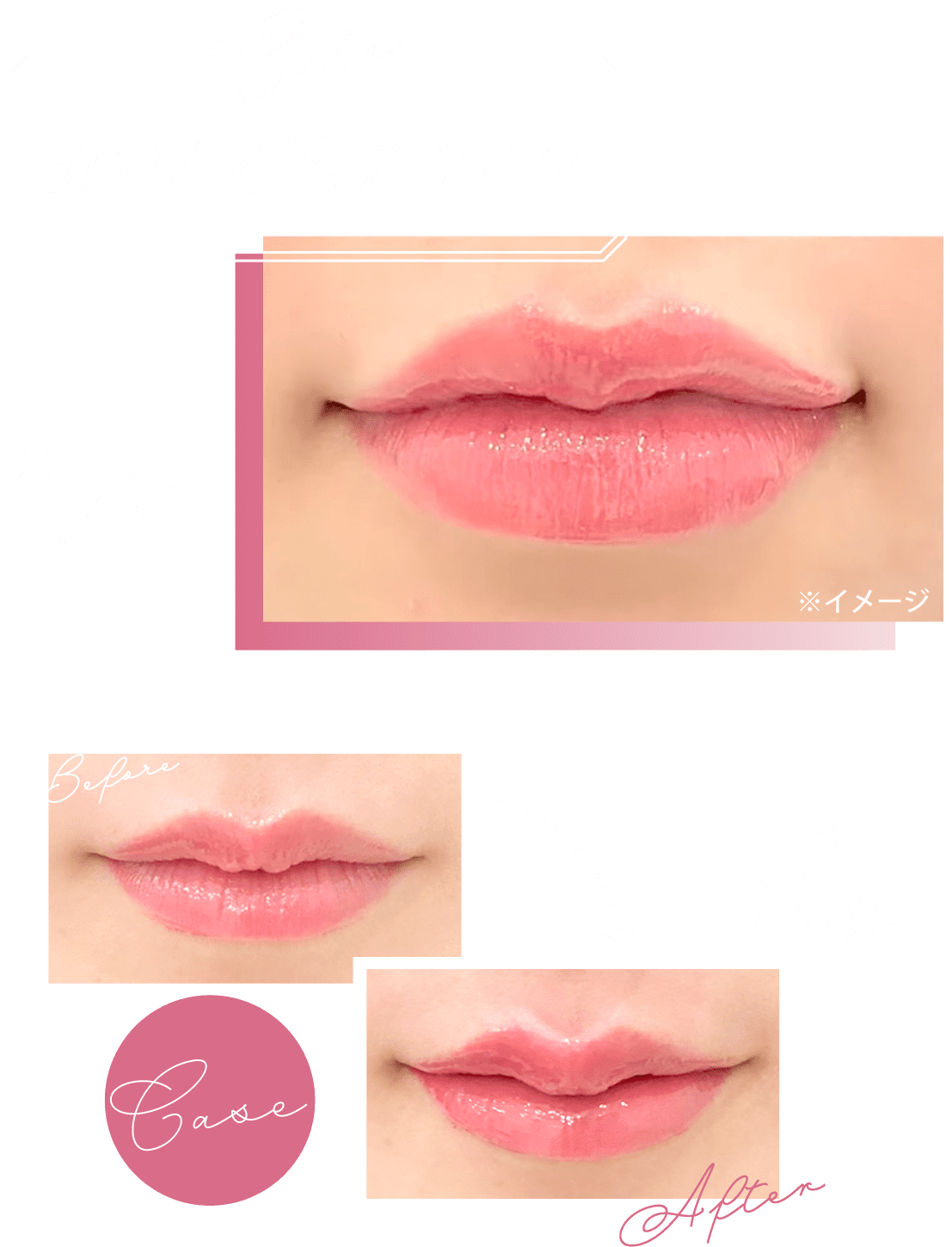 スマイルリップのカワイイ系デザイン