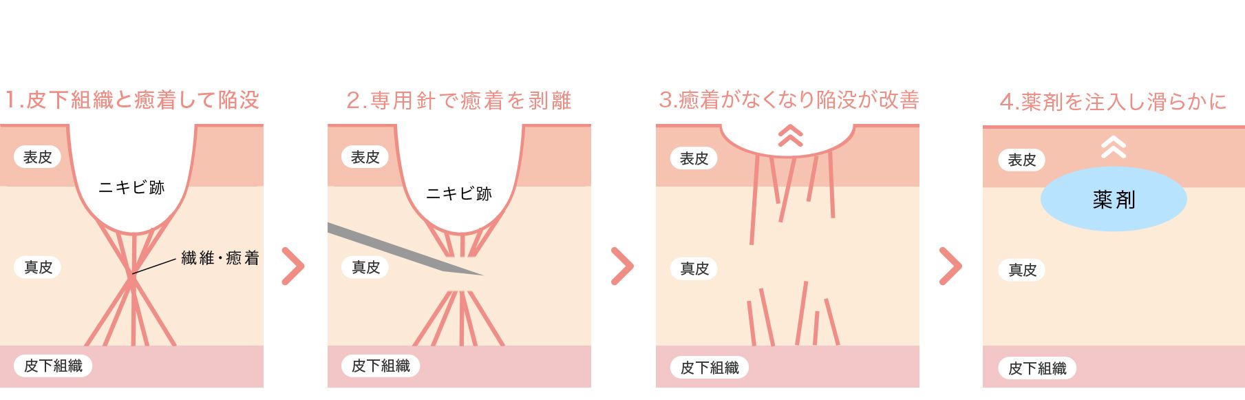 A式美肌サブシジョン