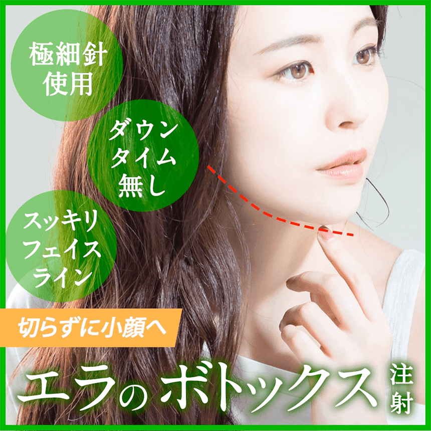 エラのボトックス注射