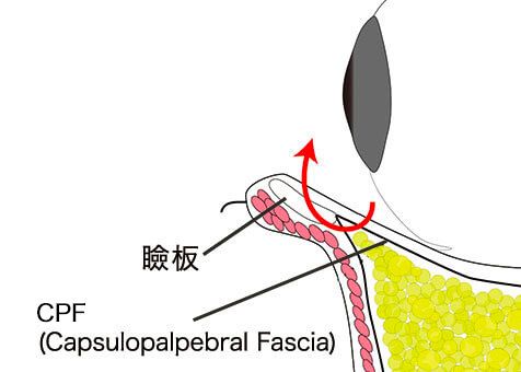 施術イメージ