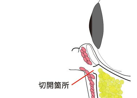施術イメージ