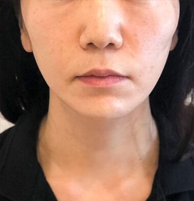 患者様写真4