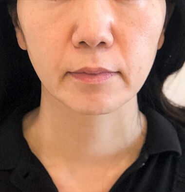 患者様写真