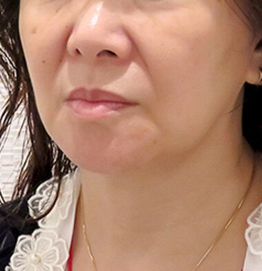 患者様写真3