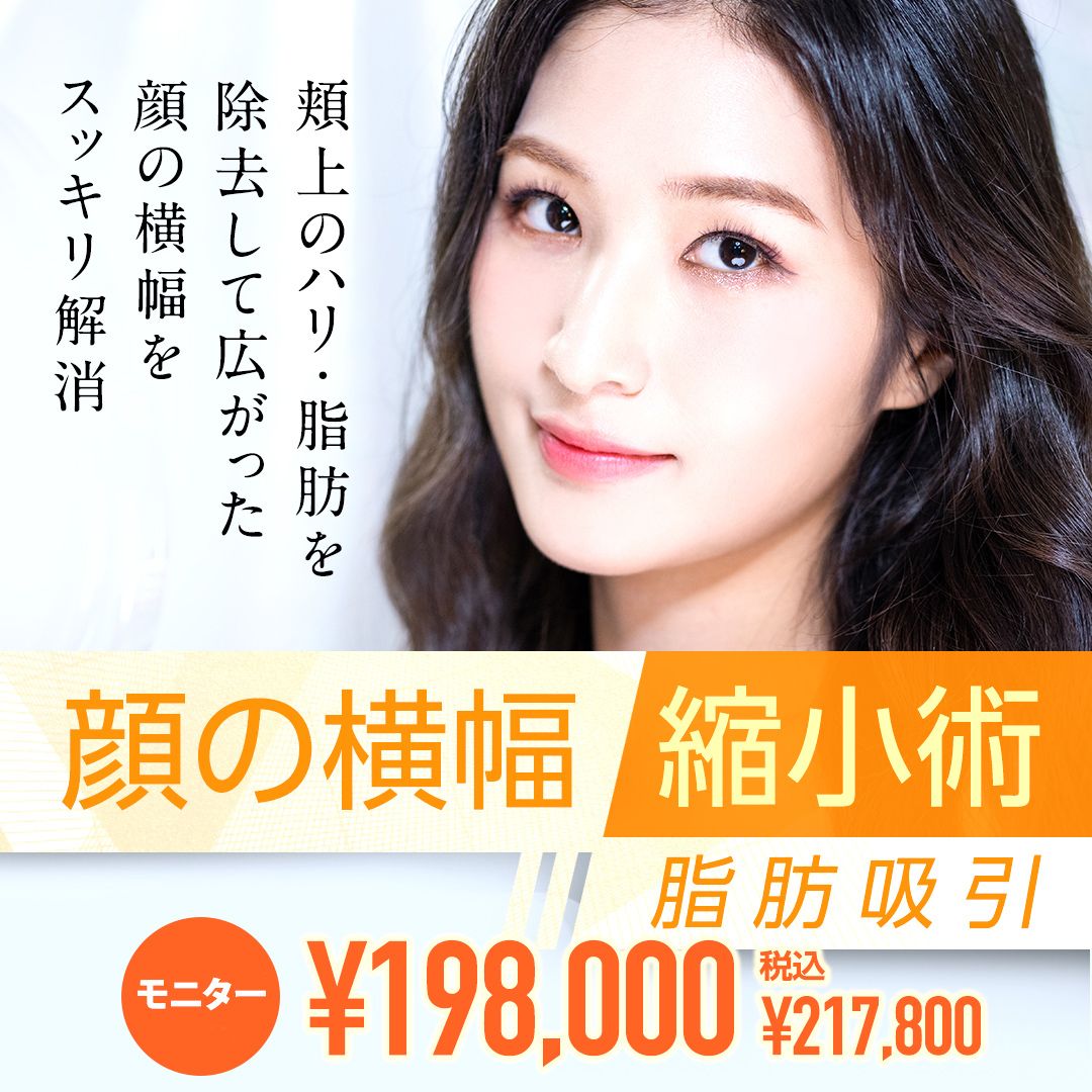顔の横幅縮小術（脂肪吸引）
