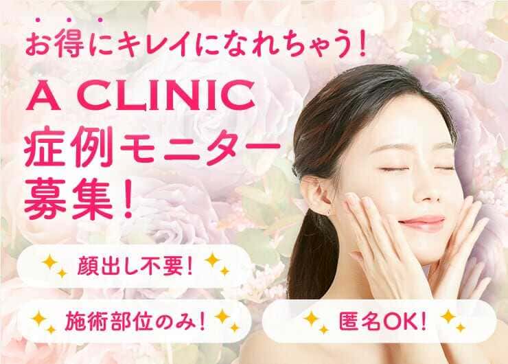 モニターFAQ