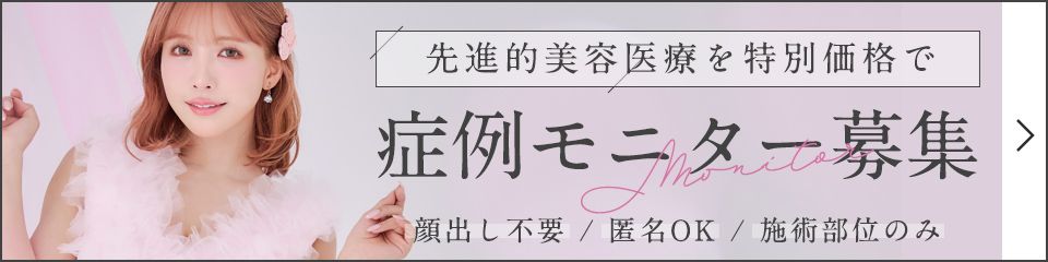 今月のモニター募集