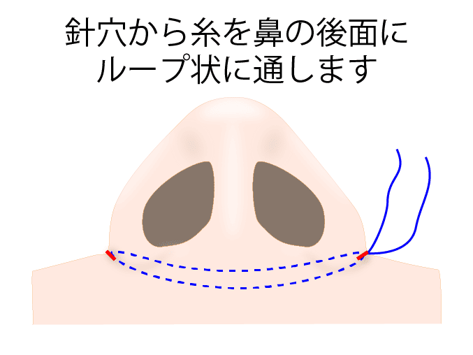 ②ループ状に糸を通す