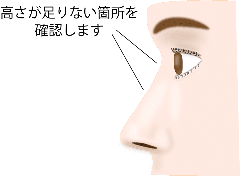 注入箇所を確認