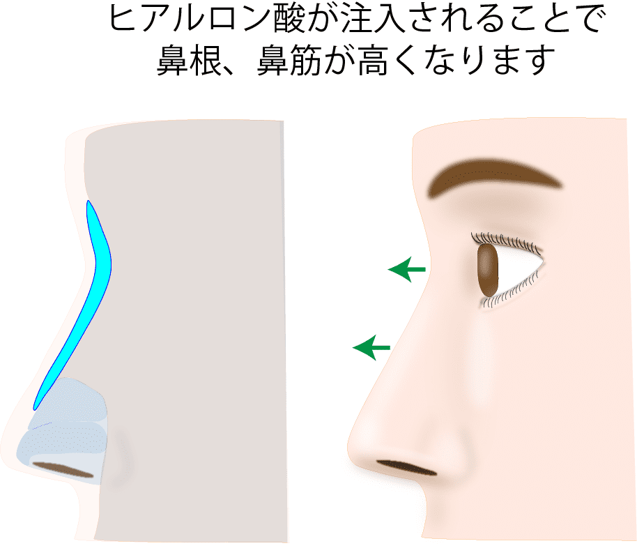 仕上がりを確認