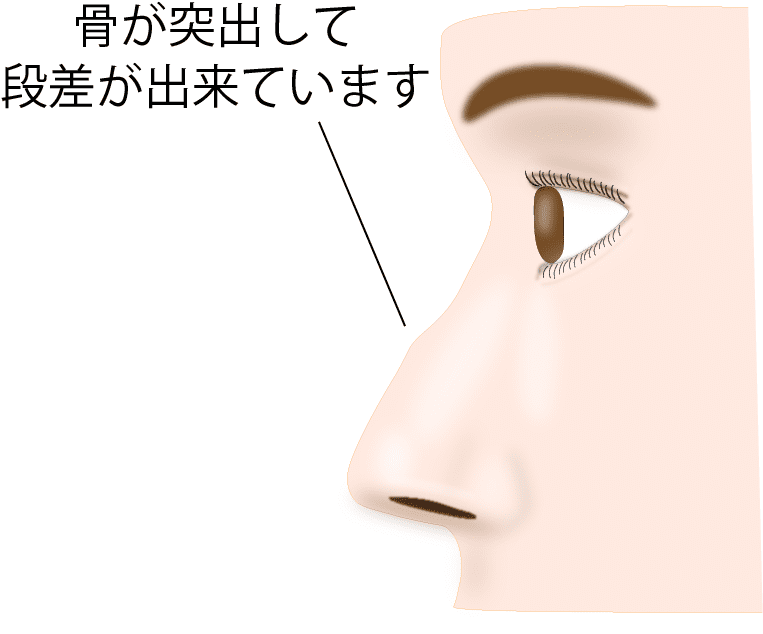 ①鼻の状態を確認