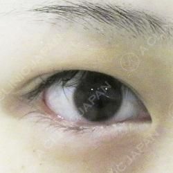 %e4%ba%8c%e9%87%8d%e5%87%a6%e7%bd%ae%e5%89%8d_1
