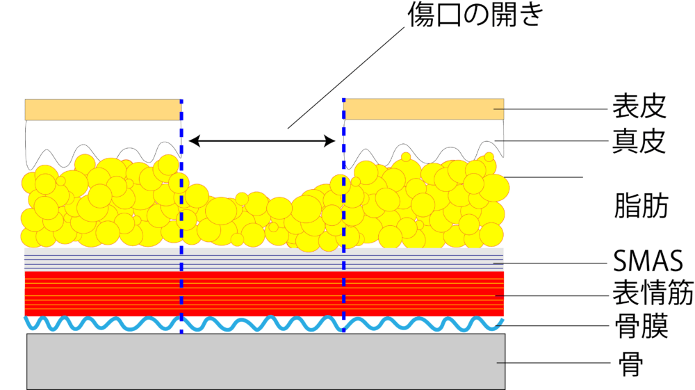創部断面