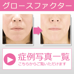 美容外科 美容整形 症例写真