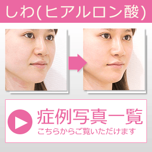 美容外科 美容整形 症例写真