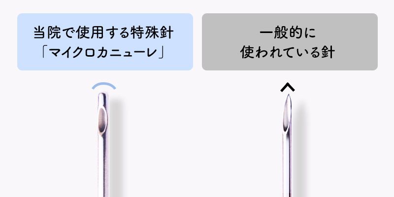 痛みが少なくダウンタイムも最小限！