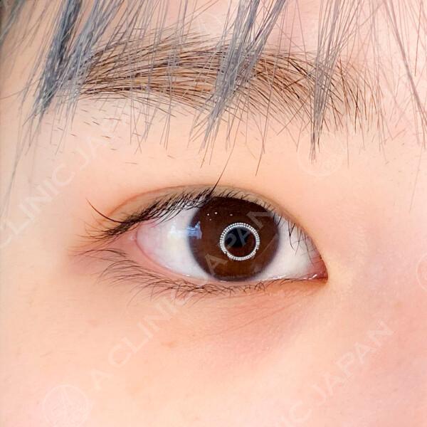 AFTER
