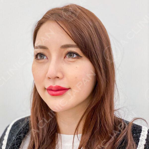 施術前