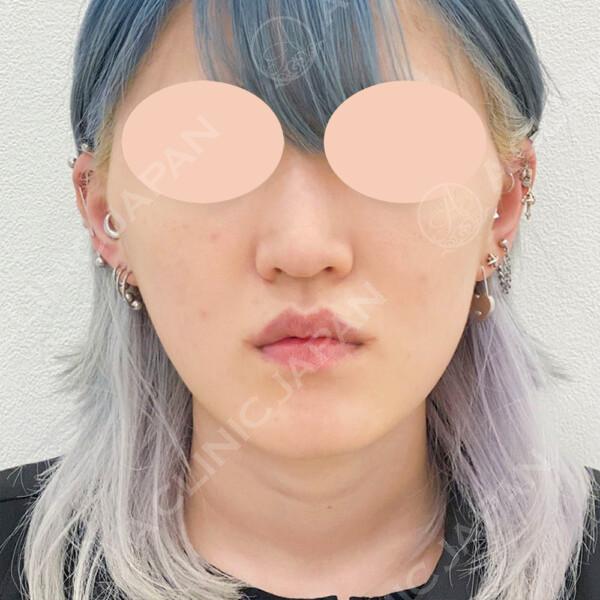 AFTER