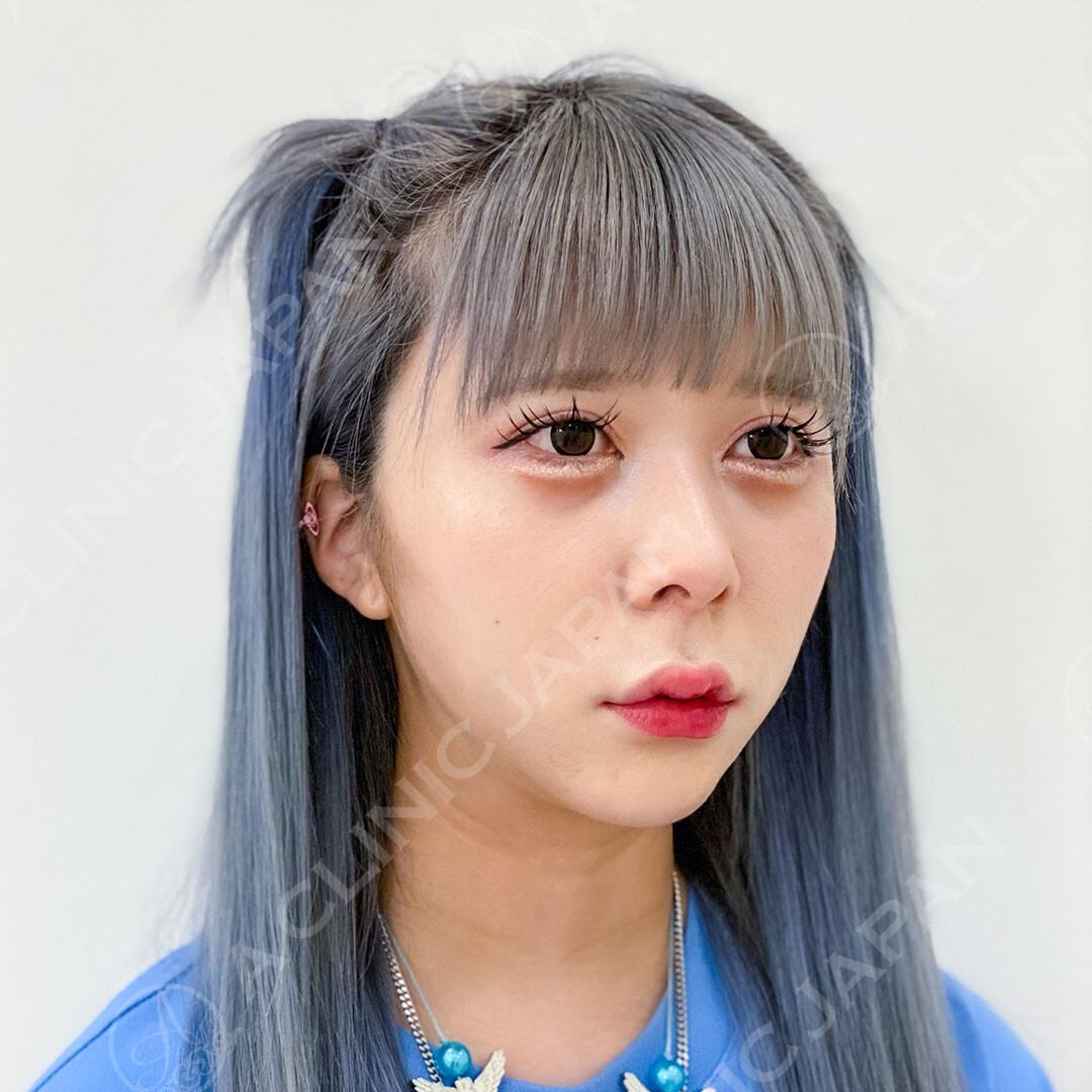 AFTER