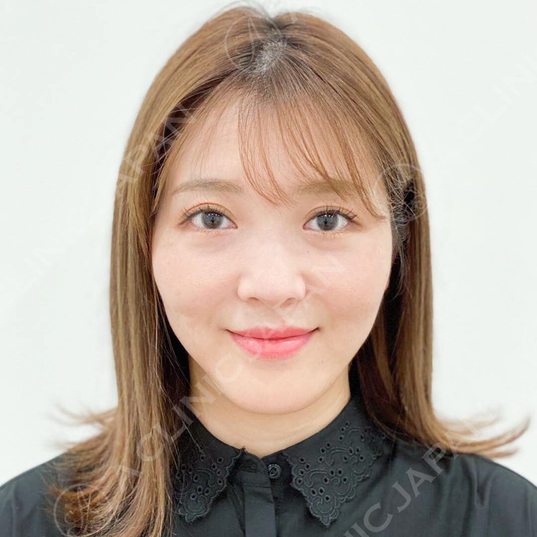 2ヶ月後