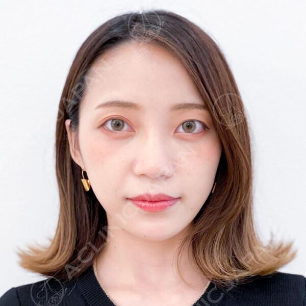 2ヶ月後