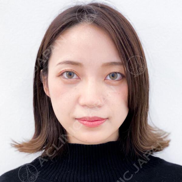 施術前