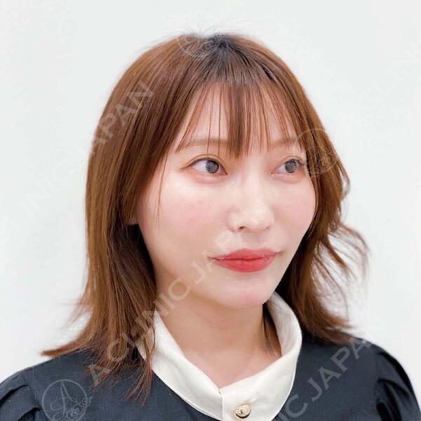 AFTER