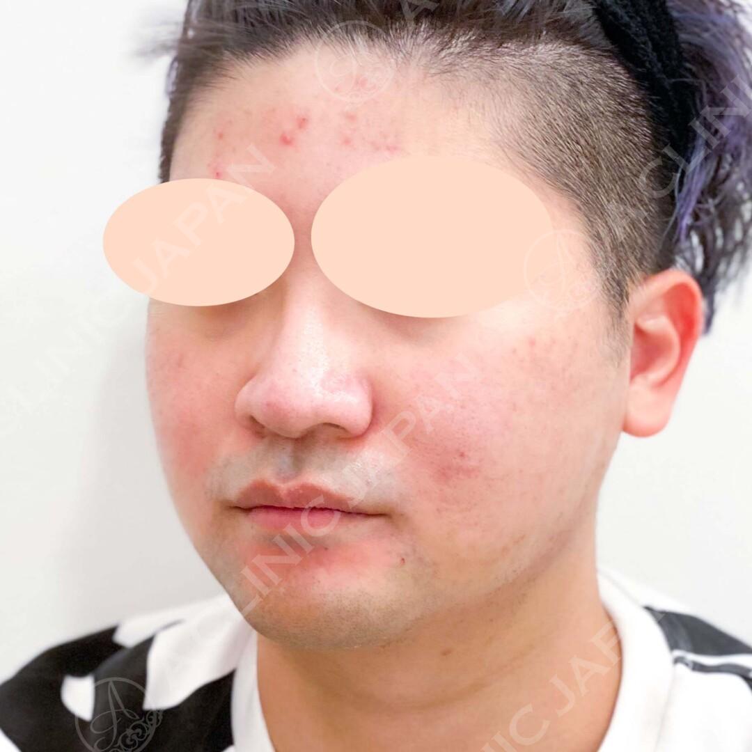 AFTER