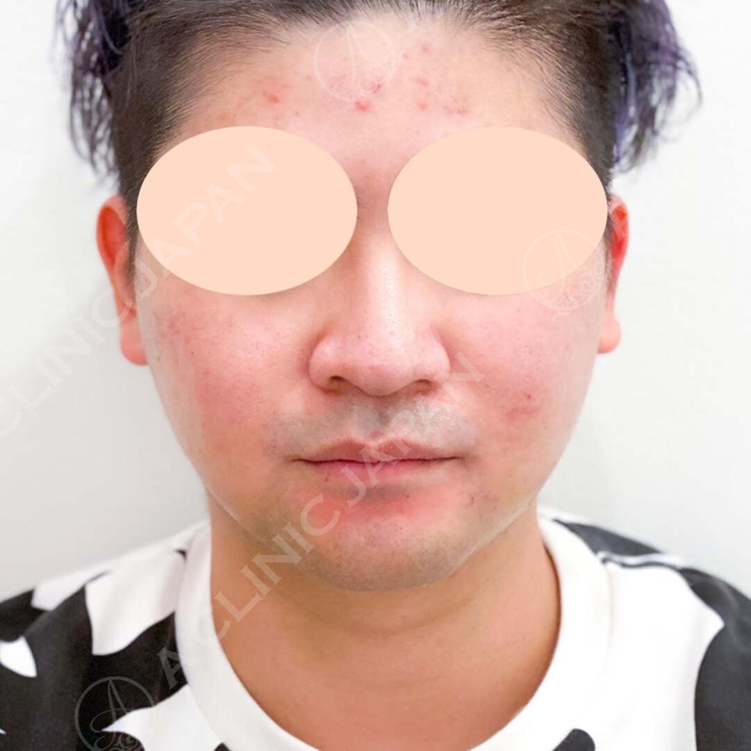 AFTER