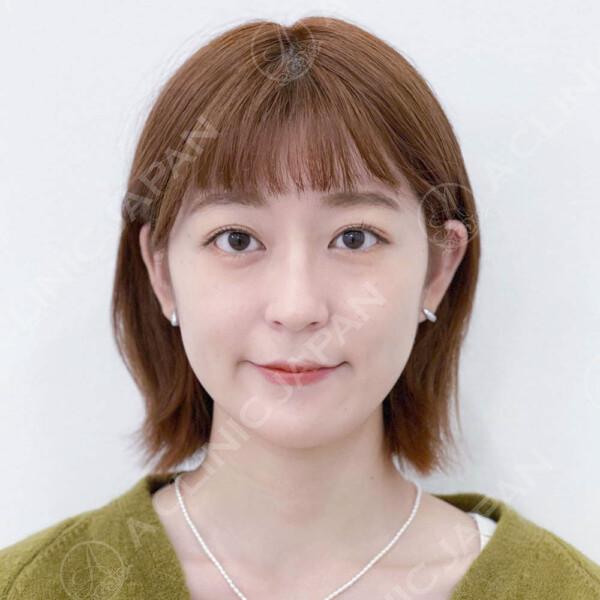 施術直後