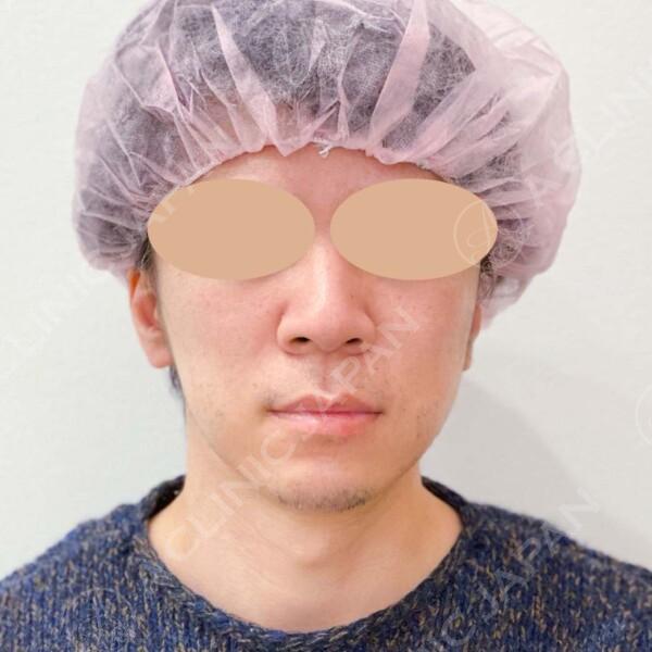 AFTER