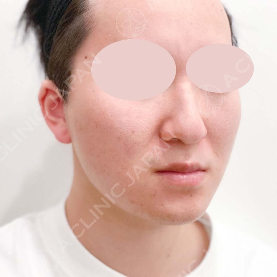 AFTER