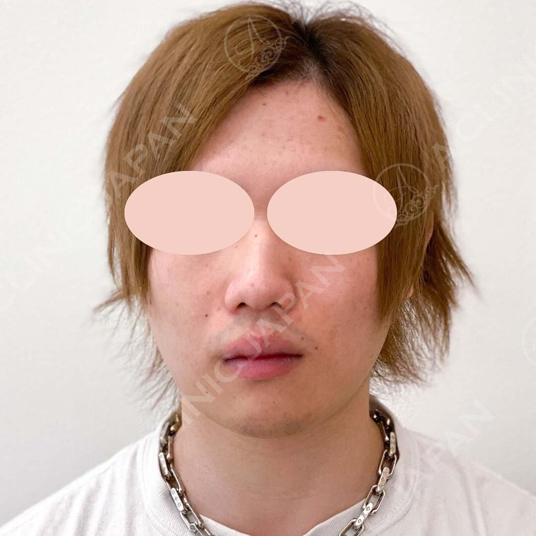 AFTER