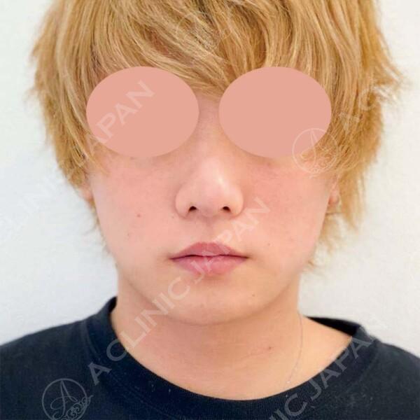 AFTER