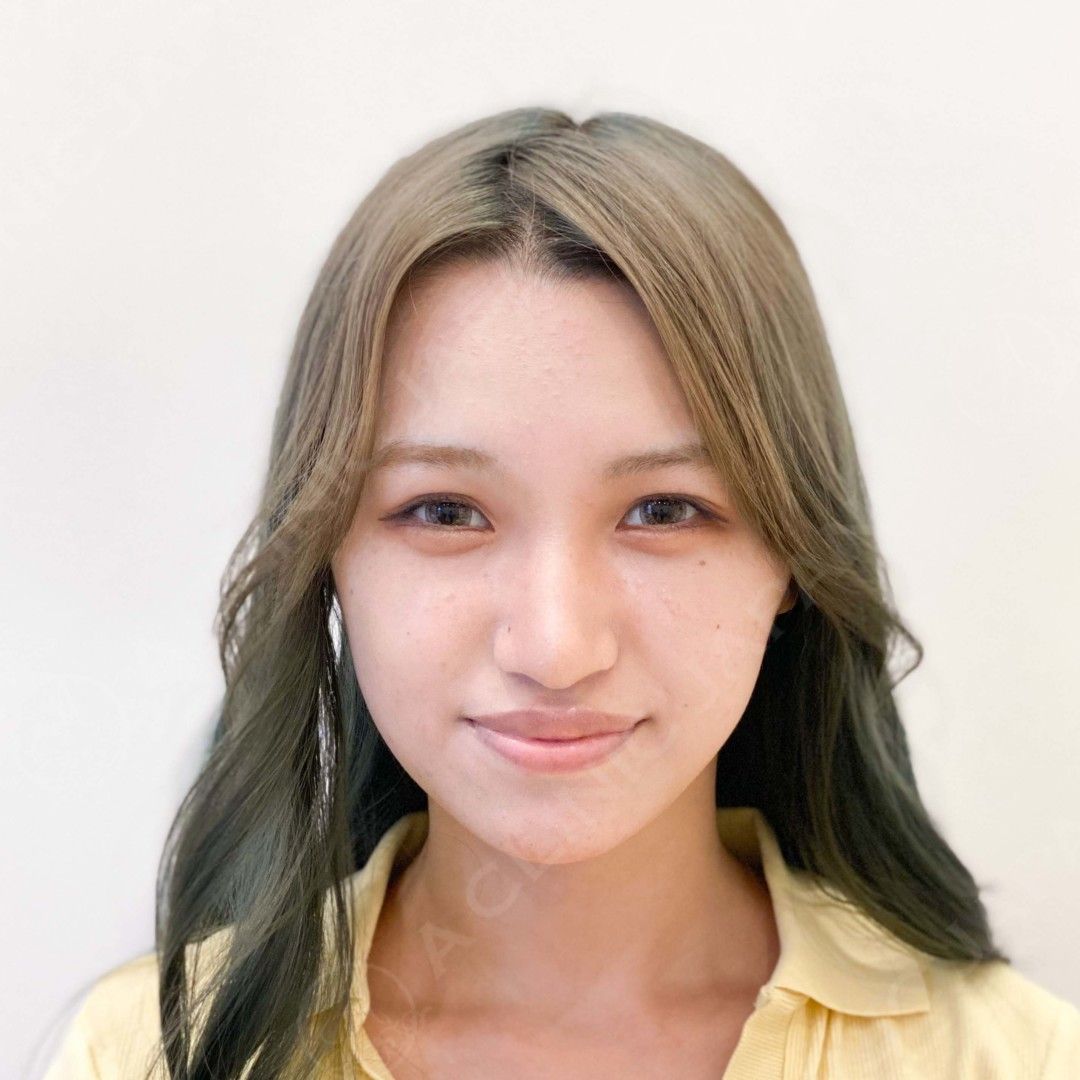 AFTER